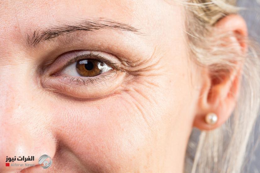 تجاعيد العينين مؤشّر مبكر لصحة الدماغ