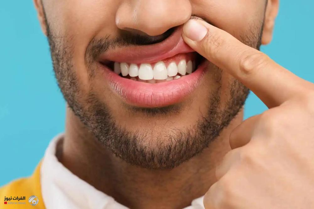 دراسة حديثة: اللثة المريضة بوابة للاكتئاب وأمراض القلب