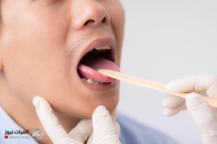 سرطان الفم.. إشارات مبكرة بلا ألم