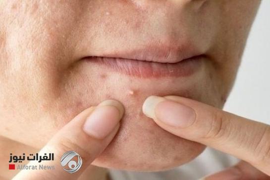 "مثلث الموت".. عادة يومية بريئة قد تنتهي بك في المستشفى