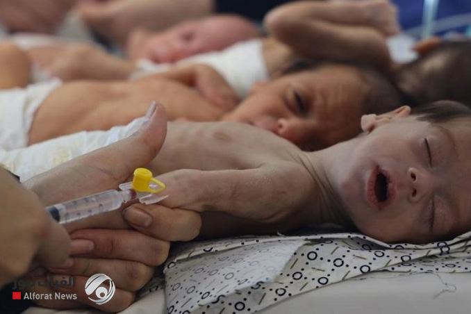 الأمم المتحدة: 14 ألف رضيع مهددون بالموت خلال 48 ساعة في غزة