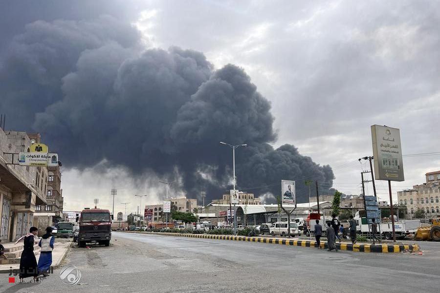 اليمن.. 183 شهيداً وجريحاً في العدوان الصهيوني على صنعاء أمس