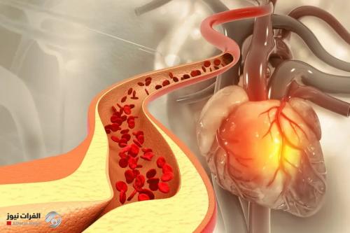 دراسة تفجر مفاجأة.. الكوليسترول "الجيد" ليس جيداً