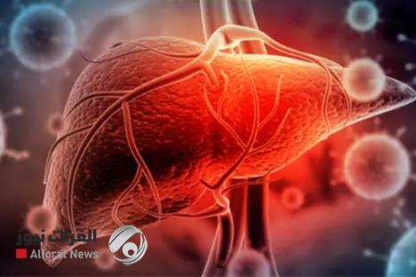 دراسة تحذر: الدهون المزمنة تعيد برمجة الكبد نحو أمراض خطيرة