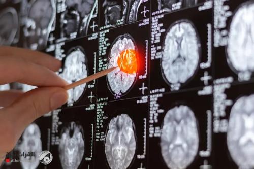 دراسة حديثة: 7 علامات تحذيرية لسرطان الدماغ قد لا تلاحظها بسهولة