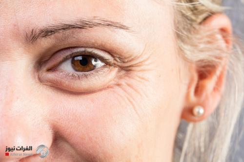 تجاعيد العينين مؤشّر مبكر لصحة الدماغ