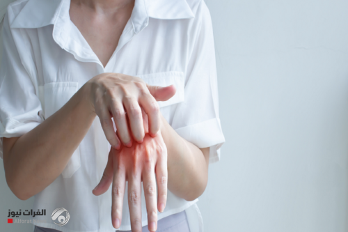 خطأ شائع أثناء الإقامة بالفندق قد يعرضك للإصابة بالجرب
